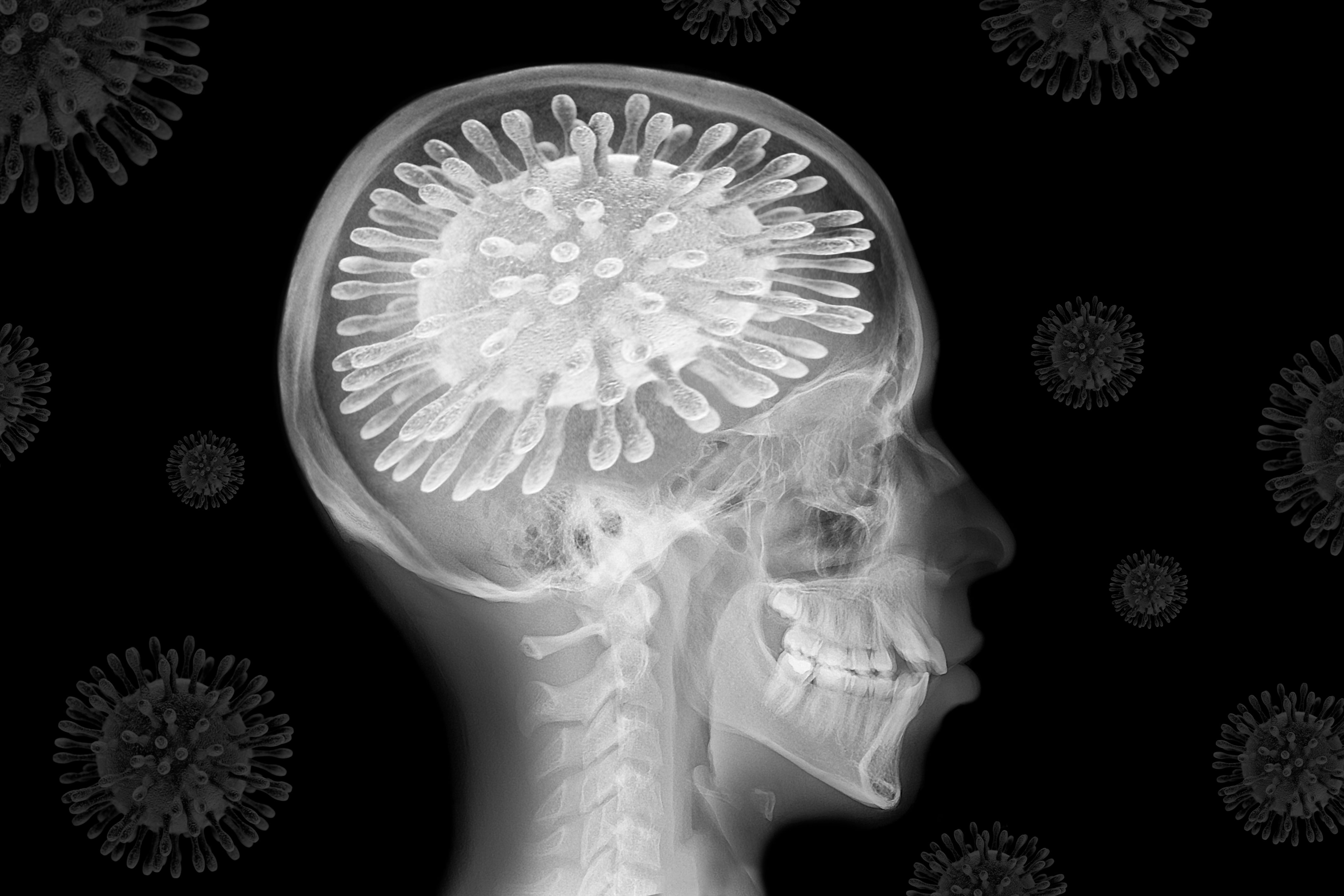 Coronavirus: The pandemic is changing our brains –  here are the remedies