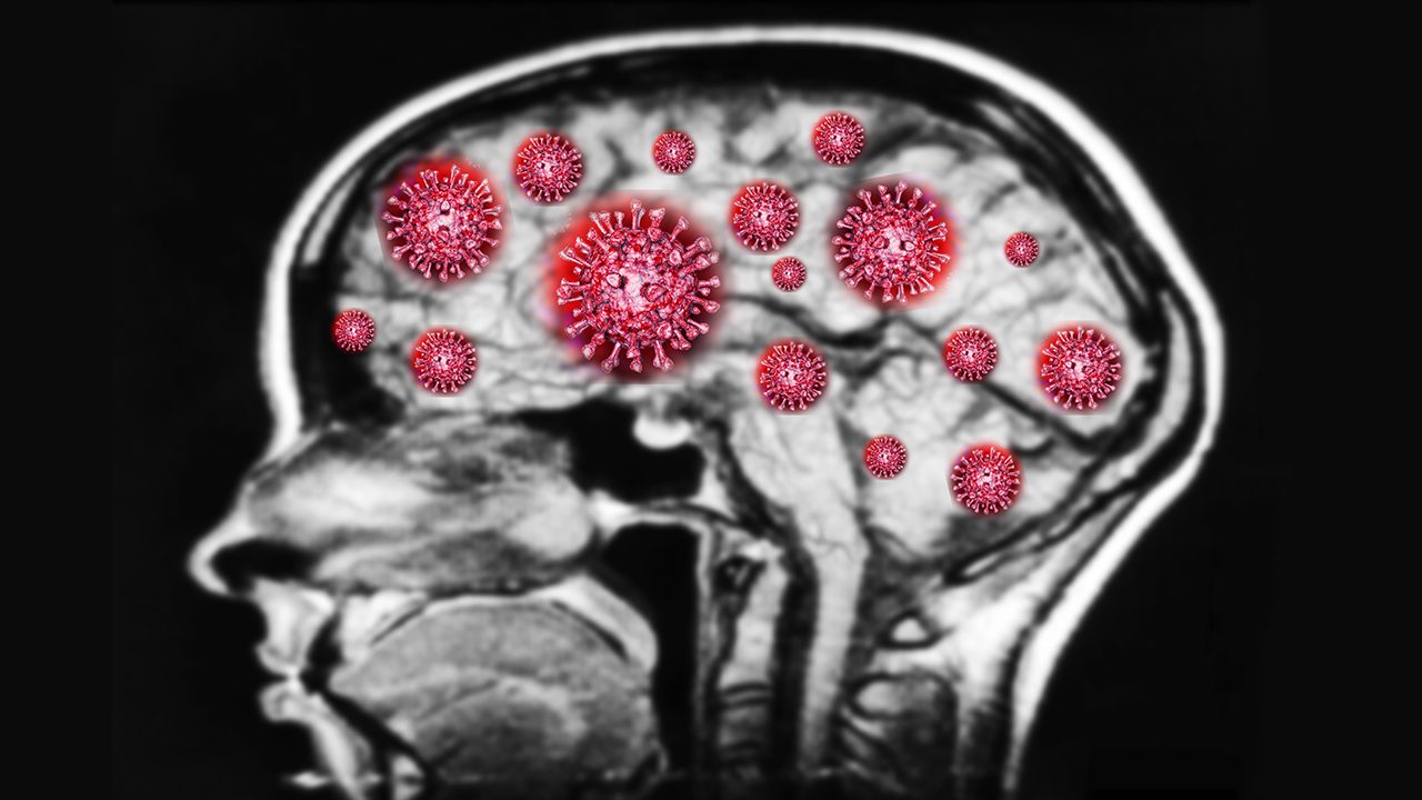 Coronavirus capable of invading brain – study