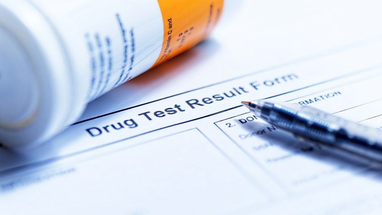 Central Visayas LTO finally scraps drug test requirement for driver’s license