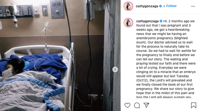 ‘Don’t ever lose hope’: Alex Gonzaga opens up about miscarriage