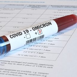 COVID-19 Omicron variant poses risks to global growth, inflation – rating agencies