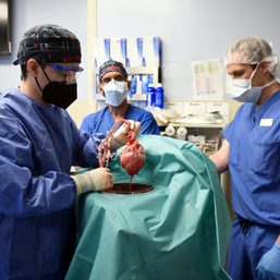 US man recovering after ‘breakthrough’ pig-heart transplant