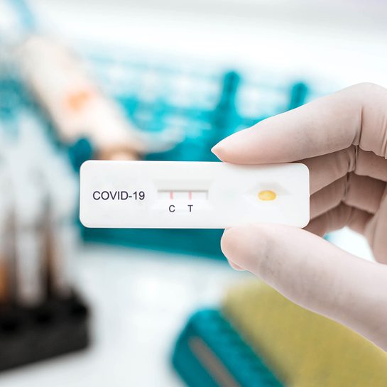 LIST: COVID-19 test kits approved by Philippine FDA