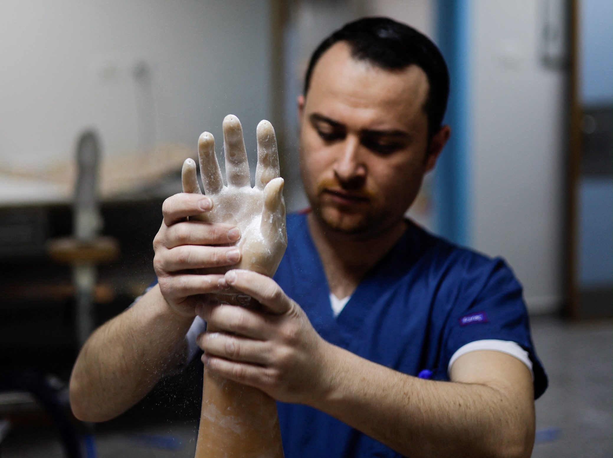 Bionic limbs lift Gaza amputees’ self-esteem