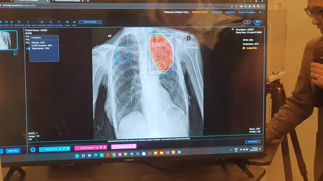 Can AI-assisted X-rays help with the Philippines’ radiologist shortage?