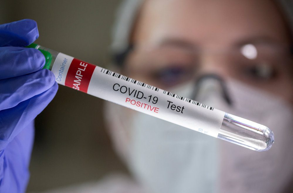 Nearly 1 in 5 adults who had COVID-19 have lingering symptoms – US study