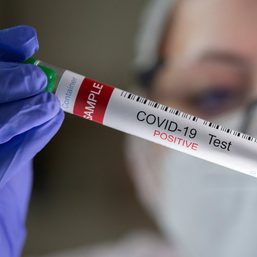 FAST FACTS: Prioritized groups, guidelines for COVID-19 vaccination