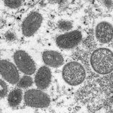 Philippines logs 2 new monkeypox cases | Evening wRap