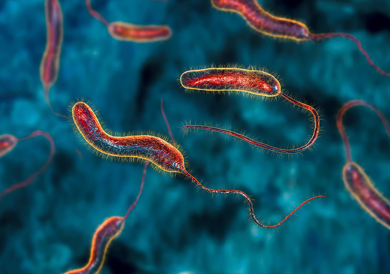 Bacolod City has 9 cholera cases, Negros Occidental records second death