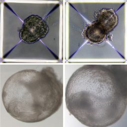 First synthetic embryos: The scientific breakthrough raises serious ethical question