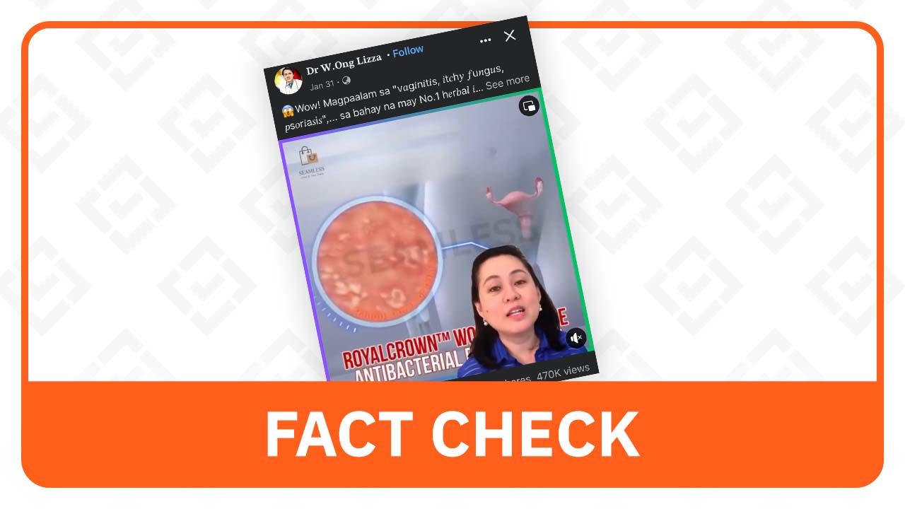 FACT CHECK: Doc Liza Ong doesn’t endorse unregistered anti-itch cream