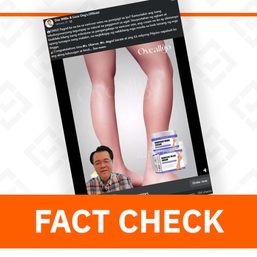 FACT CHECK: Doc Willie Ong video promoting varicose veins cream is fake