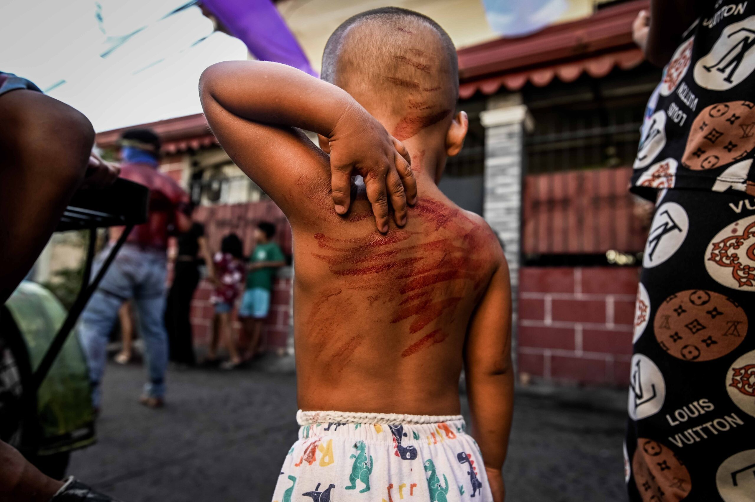 Angeles City files child abuse complaint vs parents of  boy mimicking flagellation