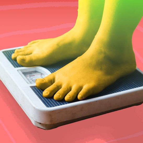 Obesity, the Philippines’ new malnutrition problem