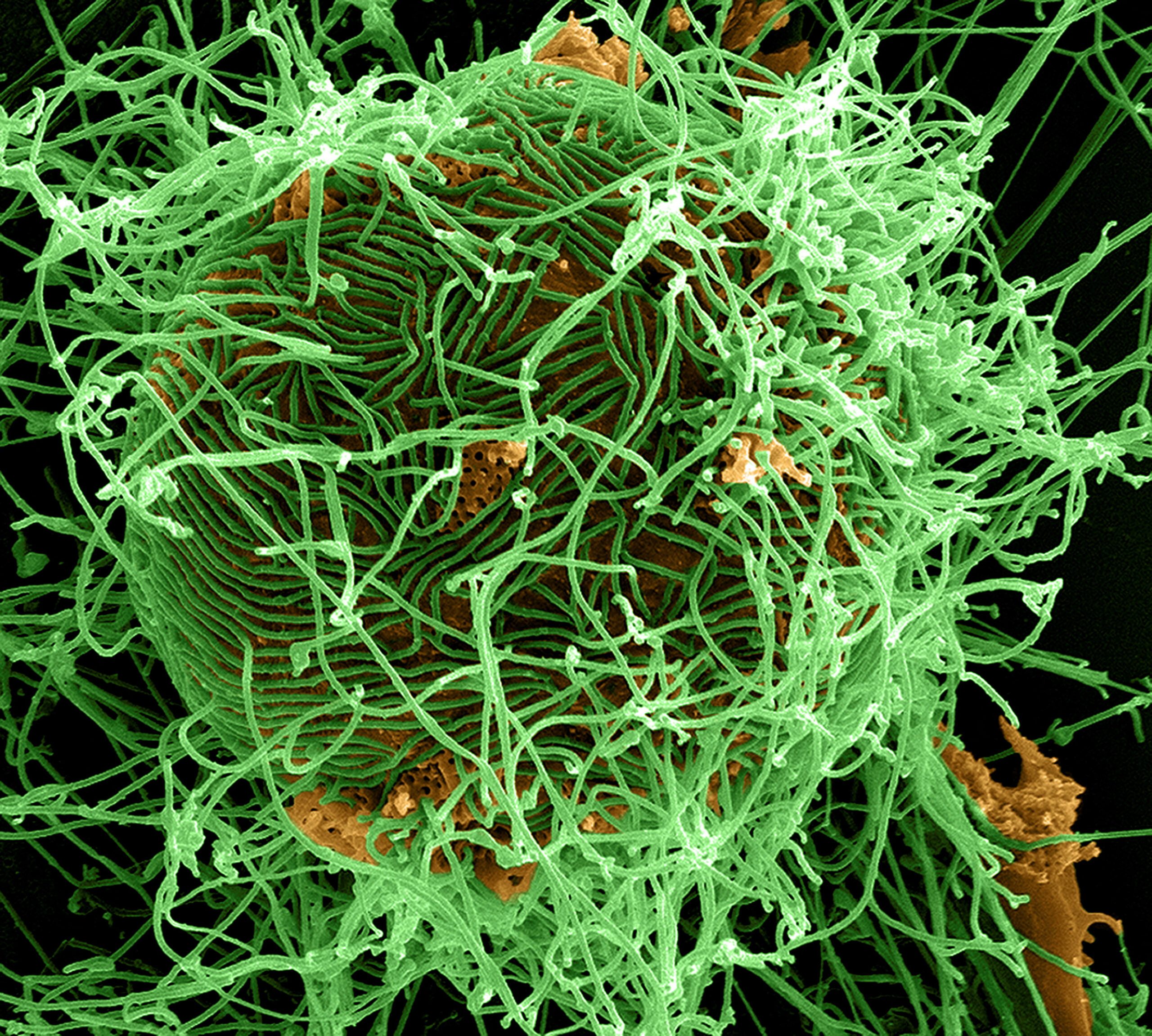 What do we know about the Bundibugyo strain of the Ebola virus?