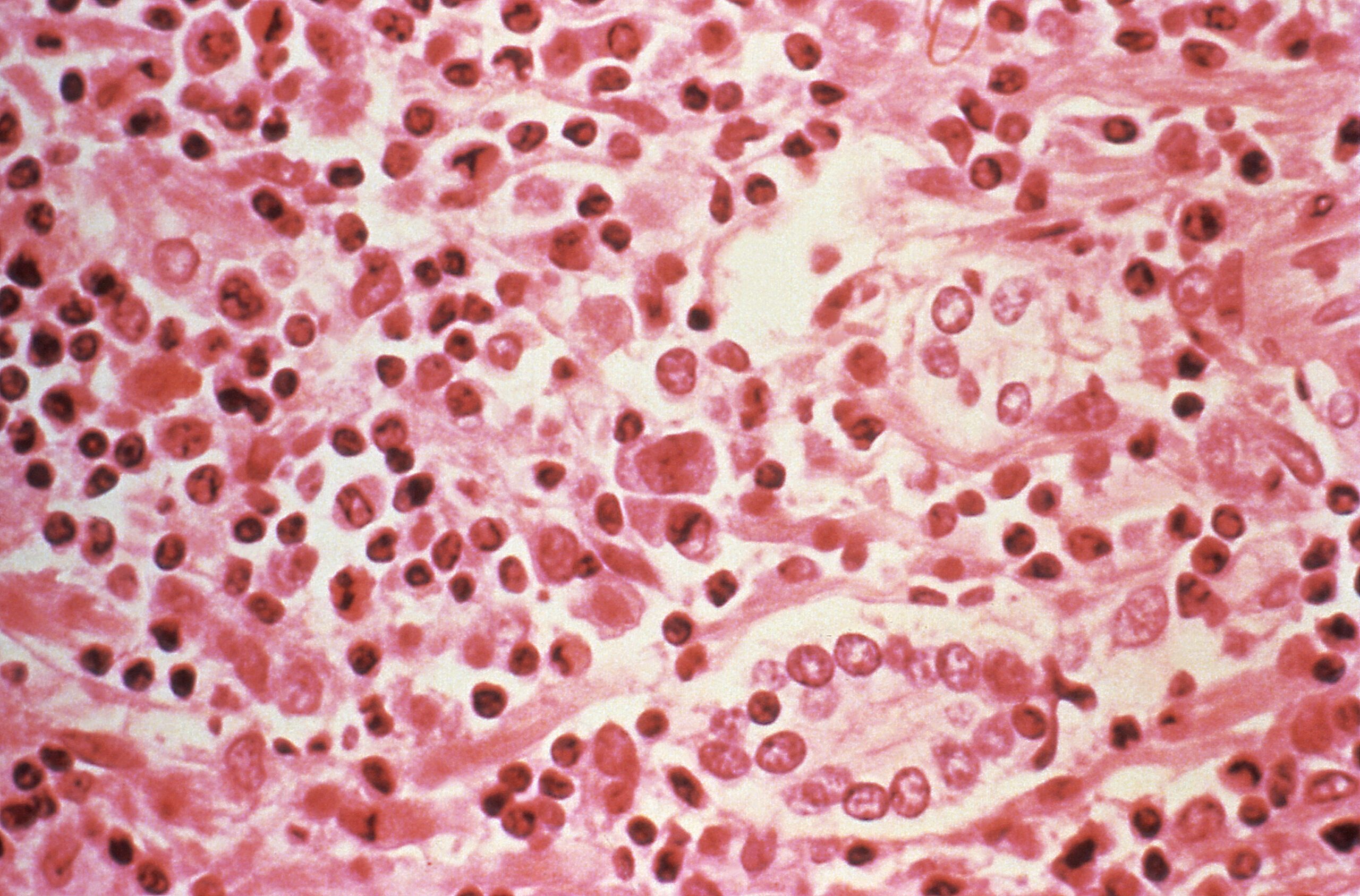Passengers on hantavirus-stricken ship sway between fear, boredom