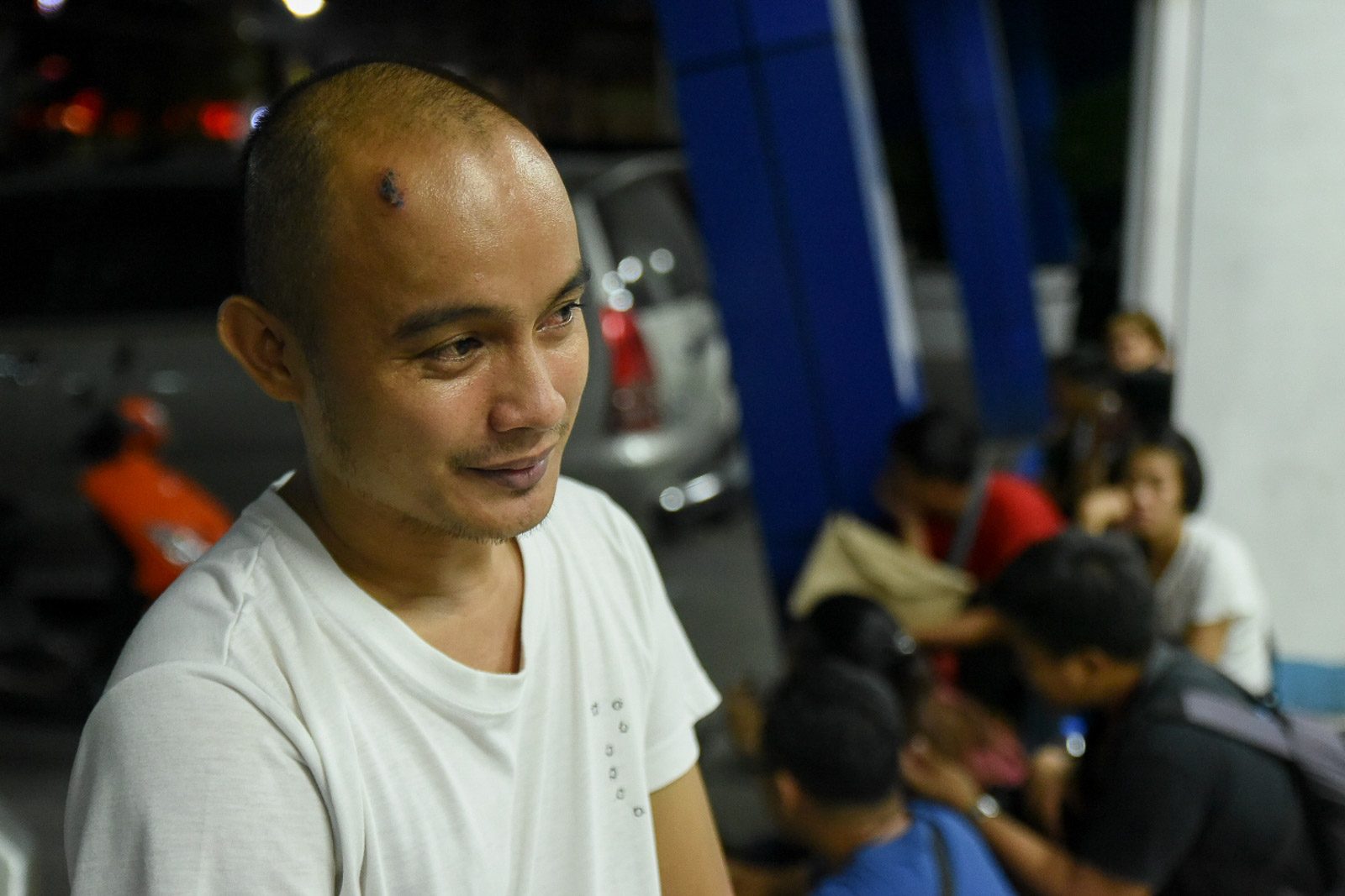 WOUNDS HEAL. Antonio Regacho Jr sustained a deep cut on his forehead from the scuffle when a hired security force tried to break up the RFC workers' picket line on November 9, 2019. Photo by Lisa Marie David/Rappler 