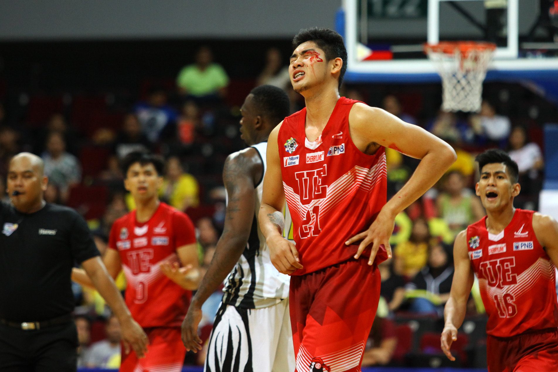 UE center Bartolome to get stitches after cut to eyebrow
