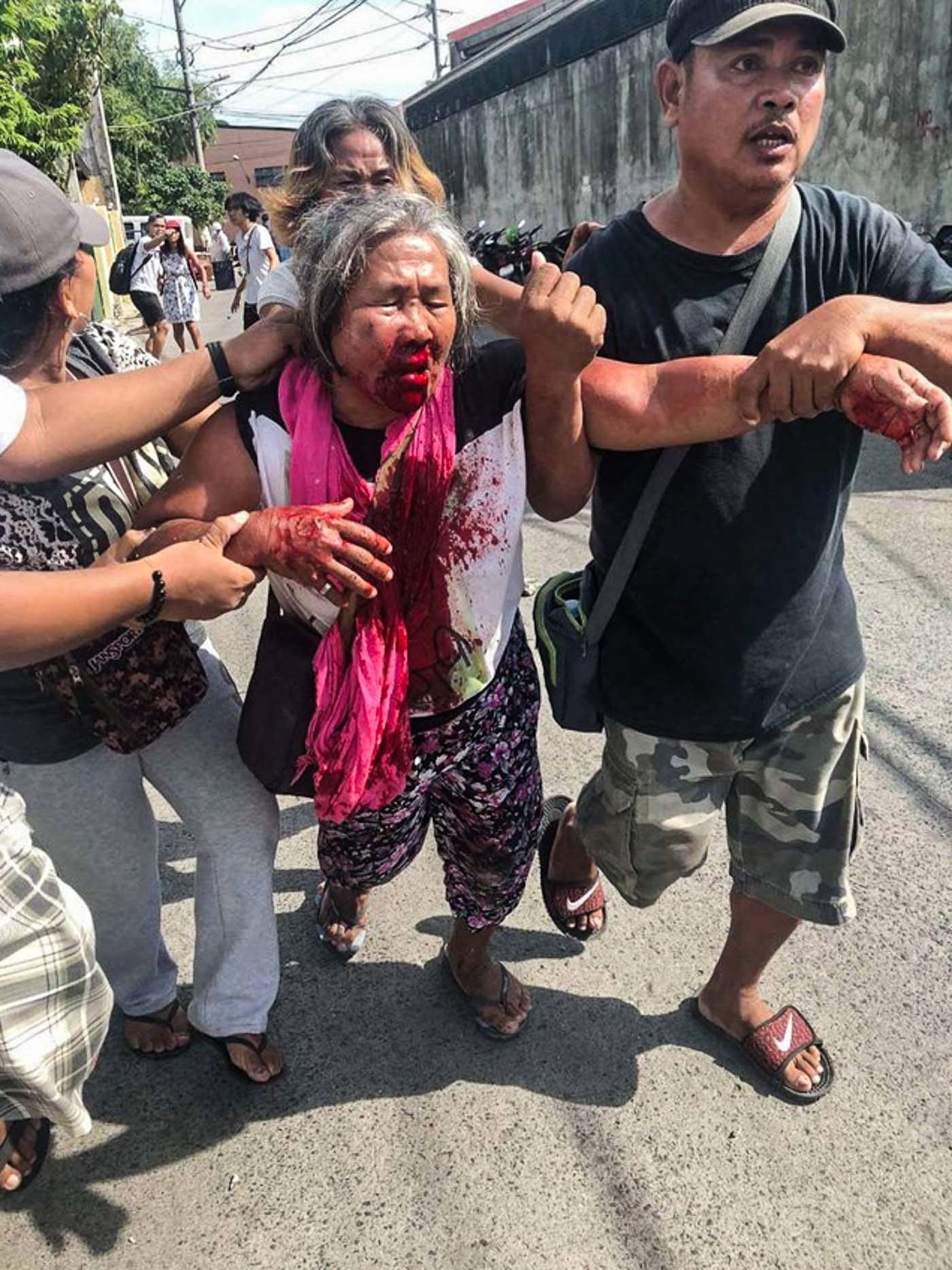 CASUALTY. Striking workers carry an elderly who was hurt after a violence erupted at the picketline of the NutriAsia plant in Marilao, Bulacan on July 30, 2018. Photo courtesy of Anakbayan  