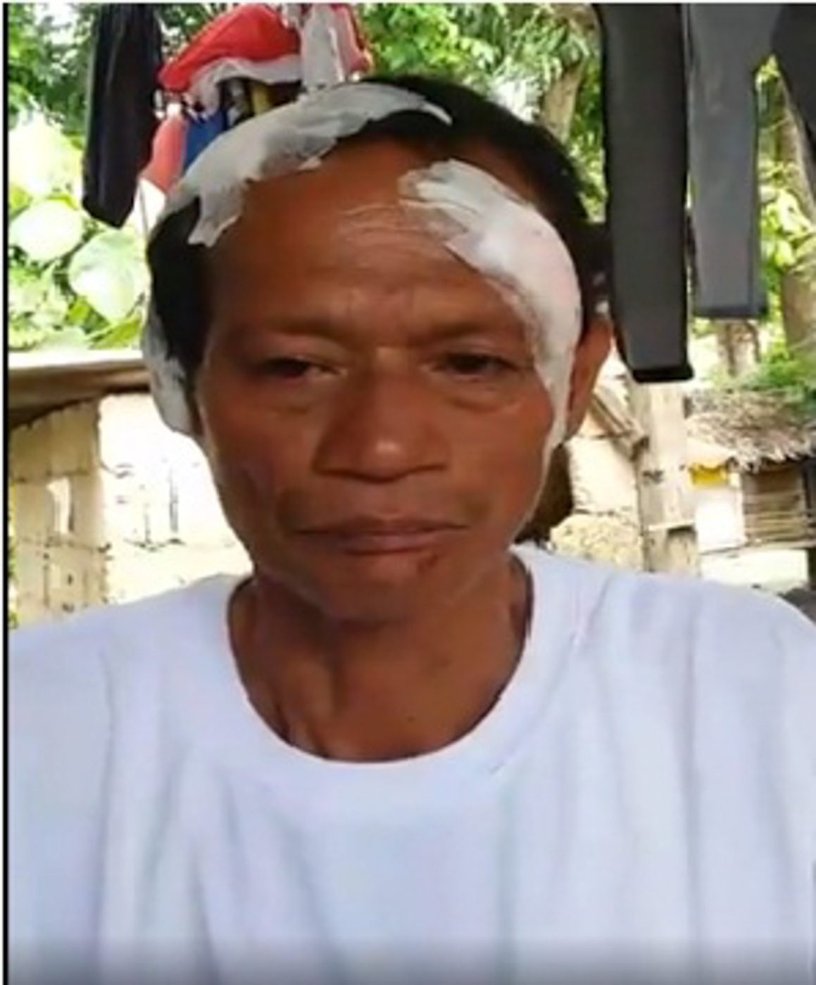 TARGET. Councilor Dela Rita had been attacked thrice before. The last attempt on his life before his death was in July 2017, according to the Guihulngan City Police, which provided this photo. 
