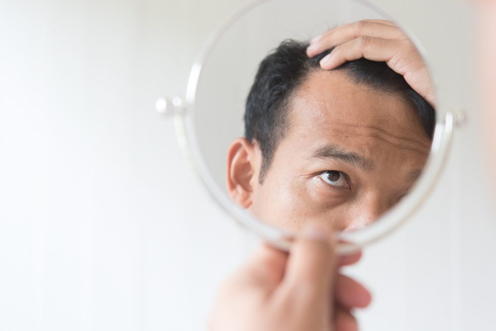 Busting myths about hair loss