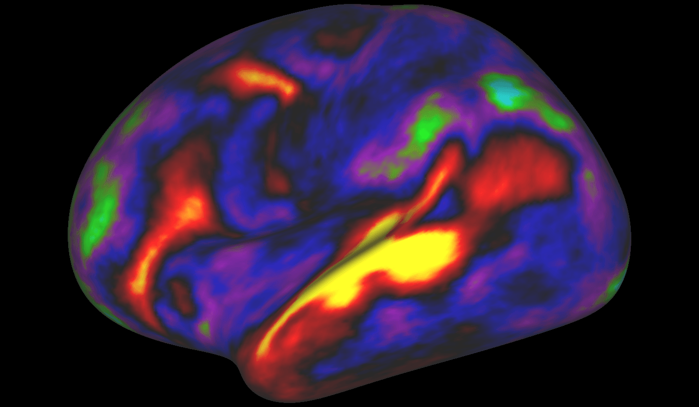 Scientists unveil detailed brain map