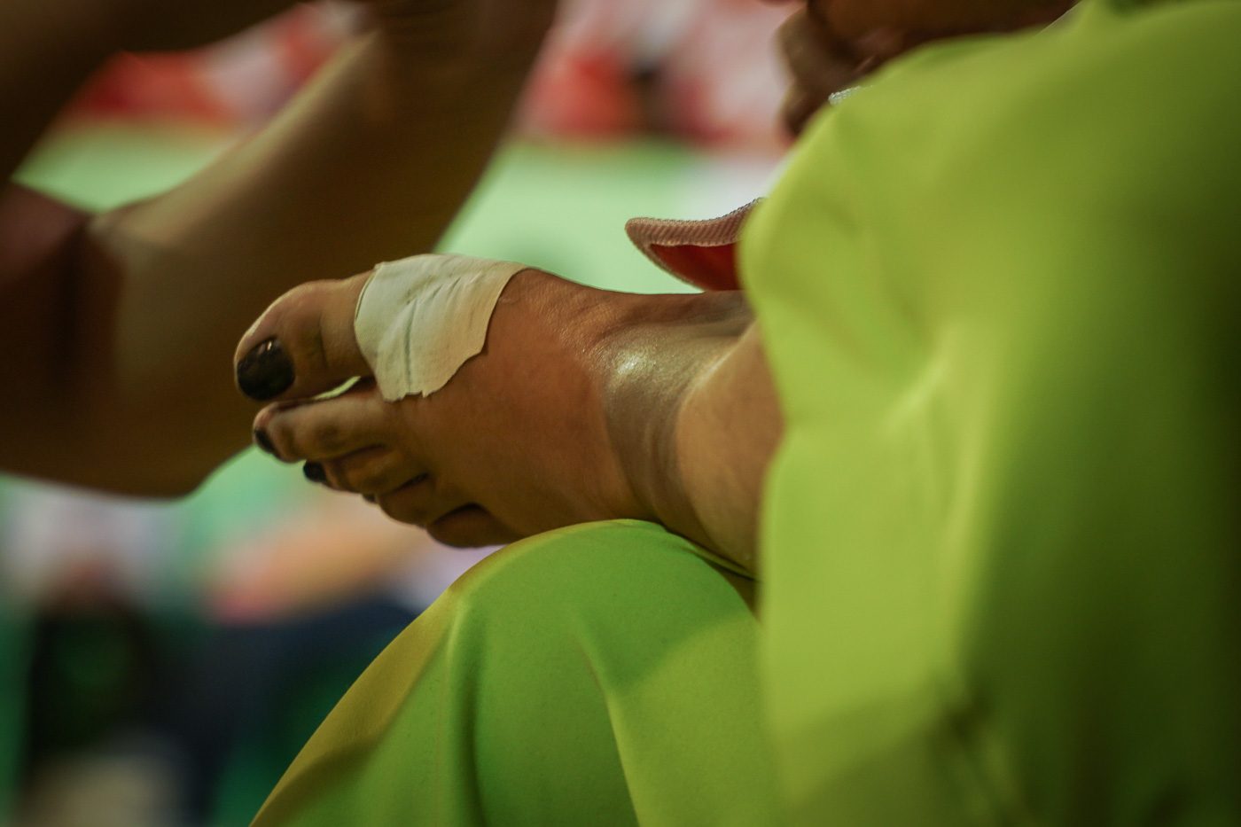 BATTLE SCAR. The prize you have to pay to reach the top. Photo by Andrea Pefianco/Rappler  