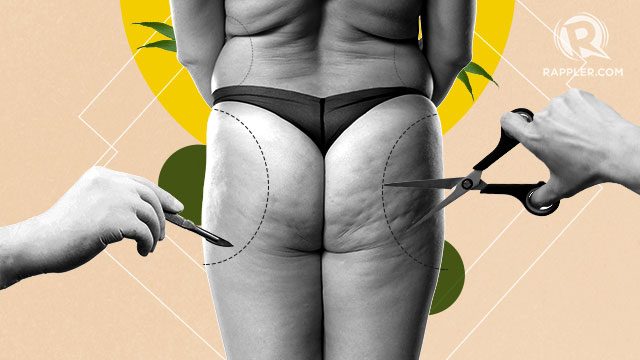Busting fat: What you need to know about liposuction