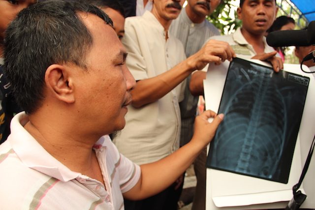 MASALAH PARU. Orangtua Luti menunjukkan hasil rontgen yang menunjukkan masalah paru-paru anaknya, ditengarai karena kabut asap. Foto oleh Denni Risman/Rappler 