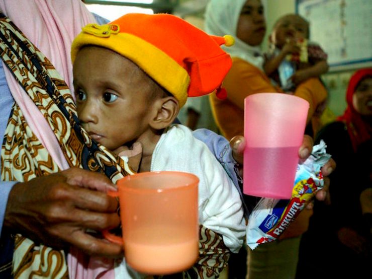 ANAK DAN KELAPARAN. Cholid Akbar, 18 bulan, Seorang anak pengidap mal nutrisi di klinik bersama ibunya, Bogor, Jawa Barat, Juni 2005. Foto oleh EPA
