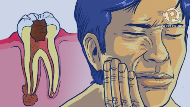 What can cause a toothache?