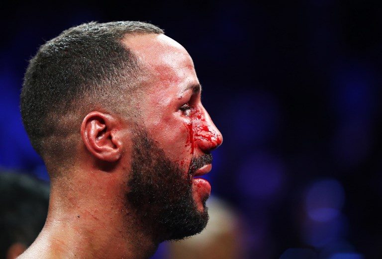 BRUISING DRAW. James DeGale looks on after his fight with Badou Jack after their WBC/IBF Super Middleweight Unification bout at the Barclays Center on January 14, 2017 in New York City. Photo by Al Bello/Getty Images/AFP 