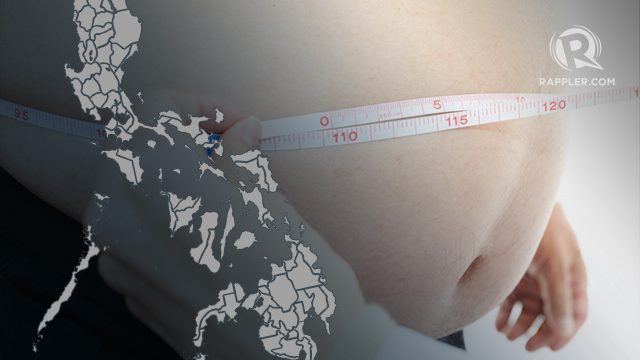 Obesity most prevalent among the richest in PH