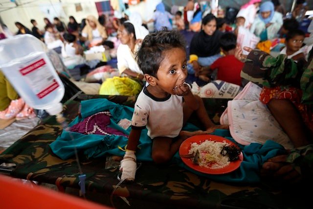 Seorang anak Rohingya sedang sarapan sekaligus diberi pengobatan medis di sebuah tempat pengungsian di Kuala Langsa, Aceh, Indonesia, pada 17 Mei 2015. Foto oleh Hotli Simanjuntak/EPA 