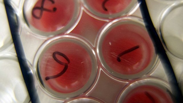 New front opens in war on superbugs – experts