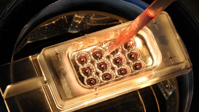 Big mistake: U.S. couple sues fertility clinic for implanting wrong embryos