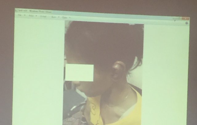 Salah satu foto yang ditunjukkan oleh LBH APIK dan menggambarkan luka bengkak di telinga sebelah kiri korban (T). Korban kini diberikan perlindungan di LPSK. Foto oleh Santi Dewi/Rappler 