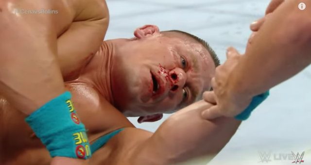 WATCH: John Cena suffers broken nose after botched knee attack