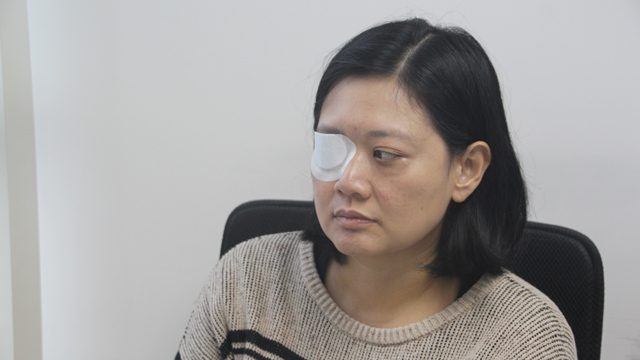 BLINDED EYE. Journalist Veby Mega Indah loses one eye to a rubber bullet fired by Hong Kong riot police. Photo by Tommy Walker/Rappler