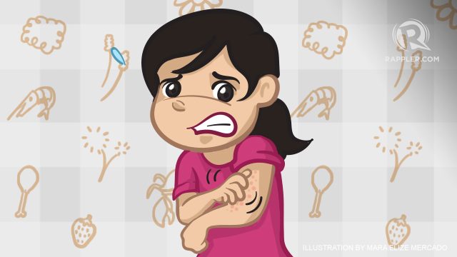 Allergic responses: Know how to react