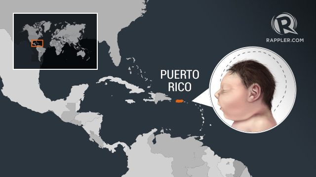 Puerto Rico declares first case of Zika-related microcephaly