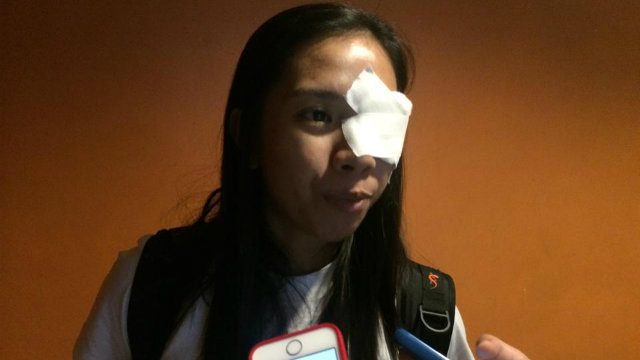 Ateneo’s De Jesus hit with eye infection, misses San Sebastian match
