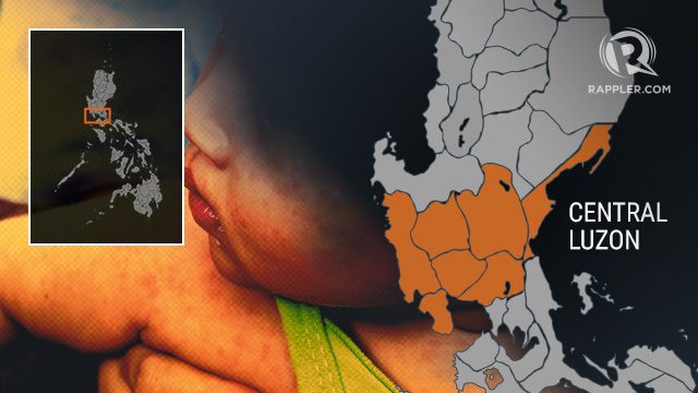 6 dead in Central Luzon due to measles