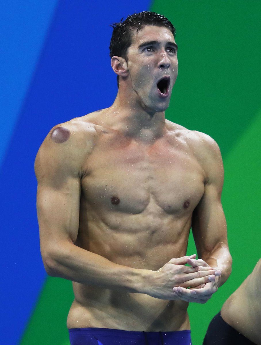 Lingkaran merah di kulit Michael Phelps dan atlet Olimpiade lainnya