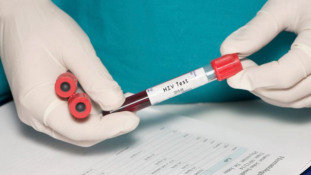 HIV patient ‘first in remission’ without transplant