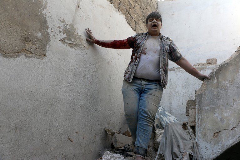 AFTERMATH. An injured Syrian man reacts as he walk amidst the rubble of a building following a reported barrel-bomb attack by the Syrian air force, in the Shaar neighborhood of the city of Aleppo, on July 27, 2014. Photo by Fadi Al-Halabi / AFP / AMC