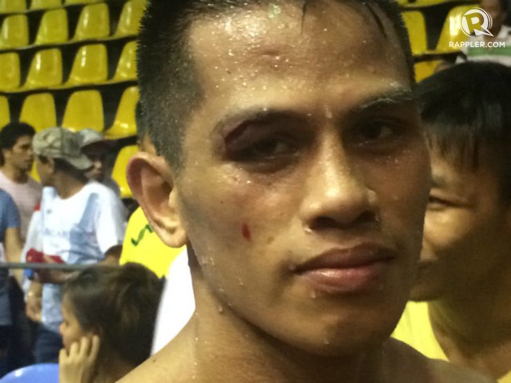 Bernabe Concepcion shows off the deep gash on his right eye from the clash of heads. Photo by Ryan Songalia/Rappler