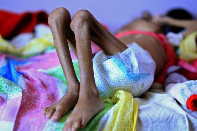 UN says war-torn Yemen ‘living hell’ for children