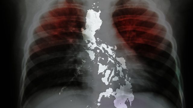 Philippines joins countries in committing to end global TB epidemic by 2030
