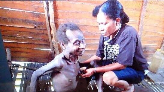 DOKTER DI PEDALAMAN. Dokter Maria Rumateray atau dokter Mia, seorang perempuan Papua yang mengabdikan dirinya dengan sepenuh hati untuk masyarakat Papua sampai ke pelosok pedalaman Papua. Foto diambil dari Facebook. 